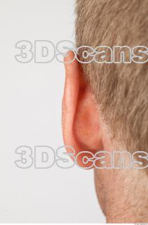 Ear texture of Alberto 0001